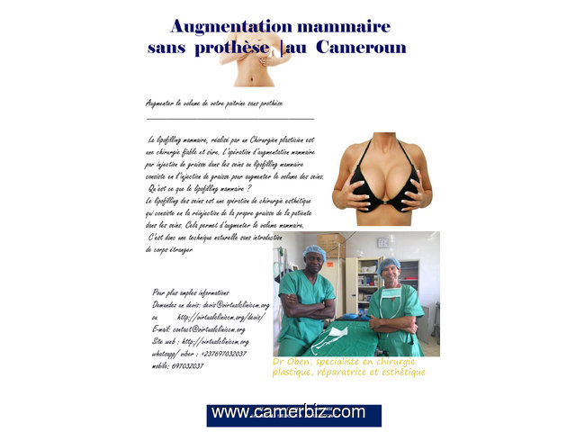 AUGMENTATION DES FESSIERS AU CAMEROUN - 1447