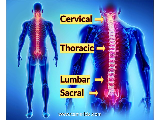 LE FLACON  LIQUIDE  DU SCIATIC  NEUROLOGIC / THE  SCIATICA NEURALGIA  DROPS - 15886