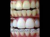 whiten your teeth in 7 days/blanchissez vos dents en 7 jours