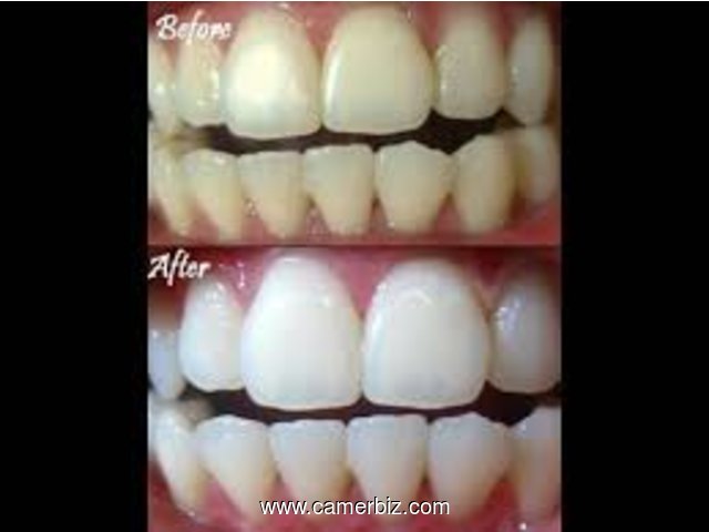 whiten your teeth in 7 days/blanchissez vos dents en 7 jours - 2626