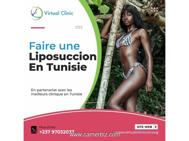 Chirurgie esthétique à Yaoundé et Douala  - 26736