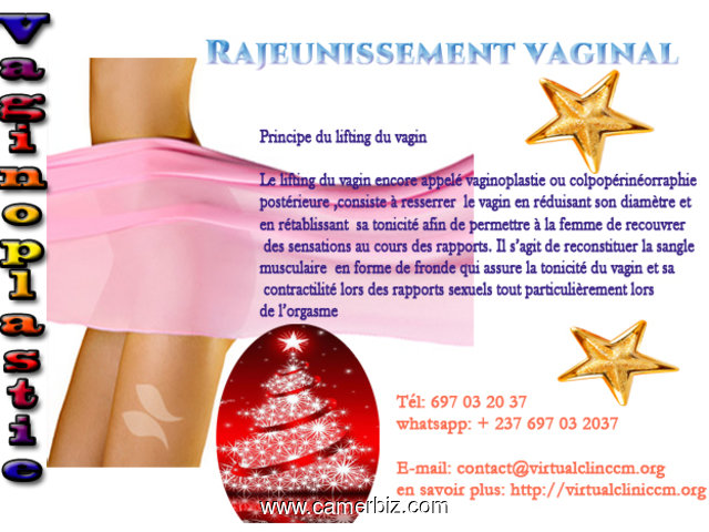 RAJEUNISSEMENT VAGINAL ( rétrécir le diamètre du vagin) - 3833