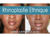 super promo de chirurgie esthétique - 3835