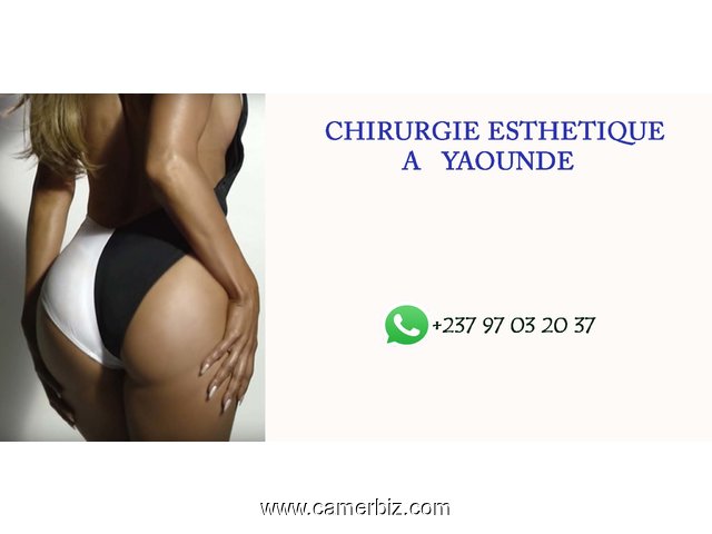 Chirurgie esthétique au Cameroun - 4521