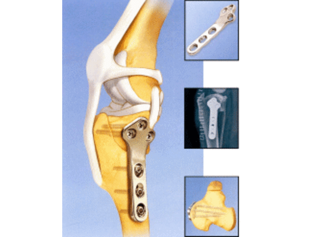Traitement  chirurgicale des lésions des ligaments croisés - 596