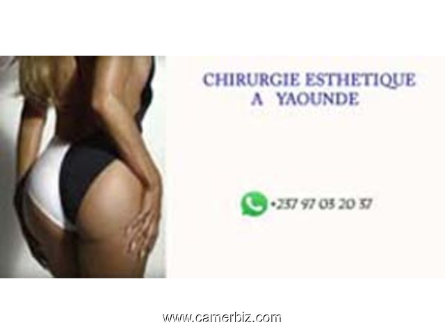 chirurgie esthétique, réparatrice au Cameroun - 9223